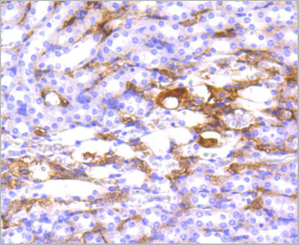 product-image-AAA30136_IHC6.jpg