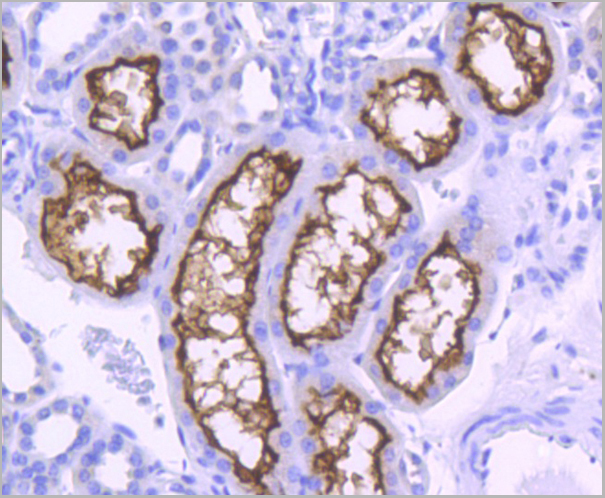 product-image-AAA30168_IHC2.jpg