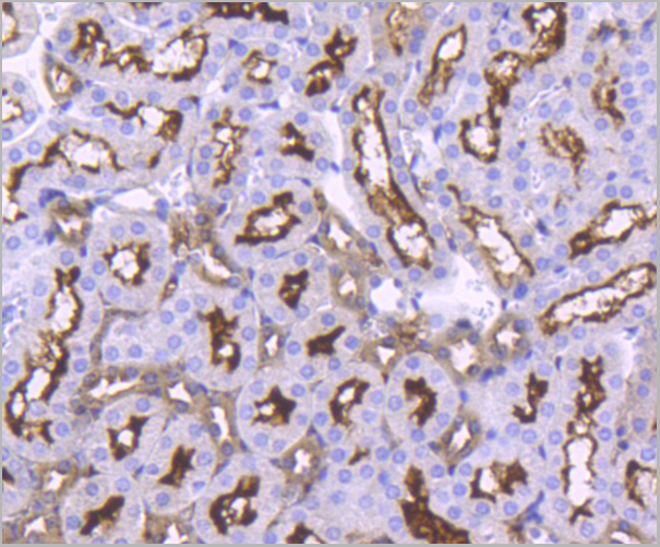 product-image-AAA30168_IHC4.jpg