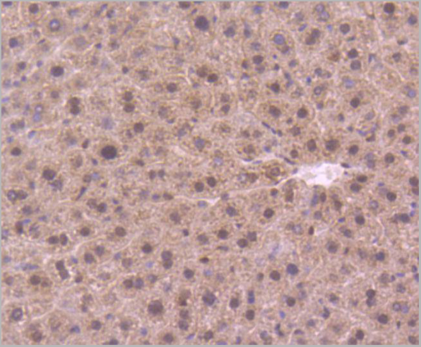 product-image-AAA30208_IHC2.jpg