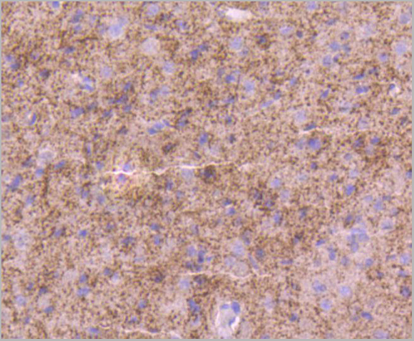 product-image-AAA30209_IHC2.jpg