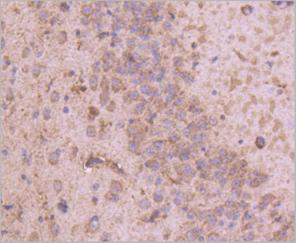 product-image-AAA30209_IHC3.jpg
