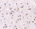 product-image-AAA302424_IHC13.gif