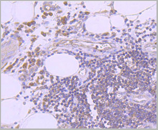 product-image-AAA30301_IHC2.jpg