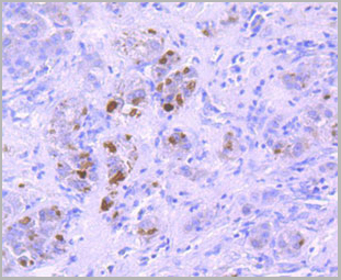 product-image-AAA30301_IHC3.jpg