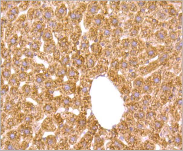 product-image-AAA30413_IHC.jpg