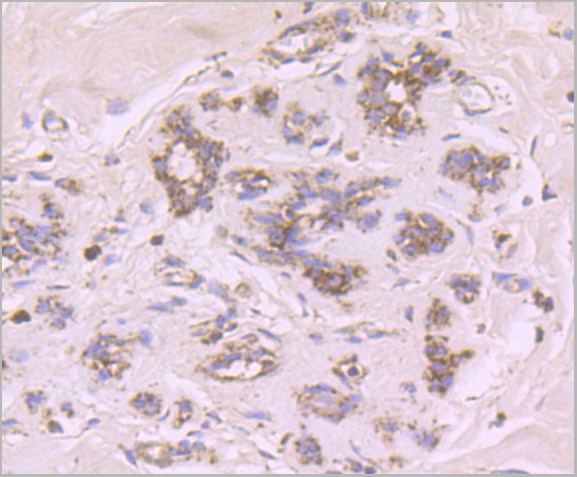 product-image-AAA30461_IHC.jpg