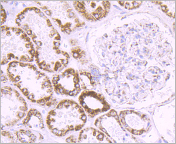 product-image-AAA30461_IHC2.jpg