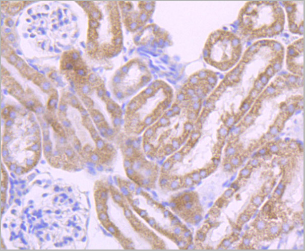 product-image-AAA30461_IHC3.jpg