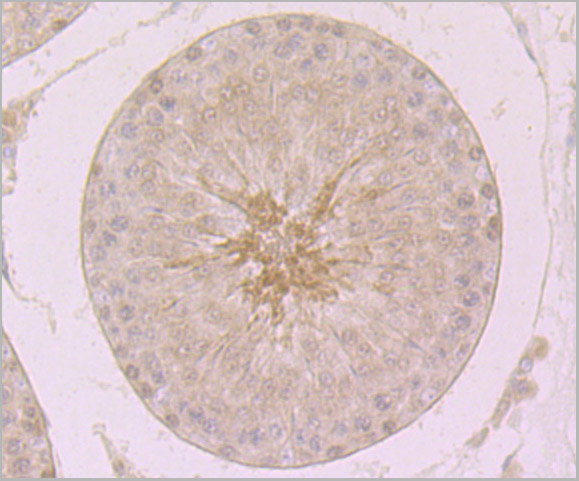product-image-AAA30464_IHC2.jpg