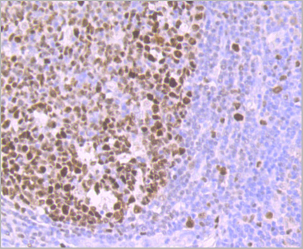 product-image-AAA30464_IHC3.jpg