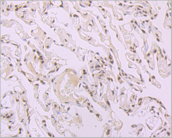 product-image-AAA30465_IHC2.jpg