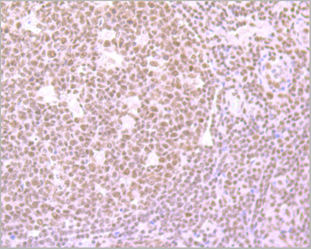 product-image-AAA30465_IHC3.jpg