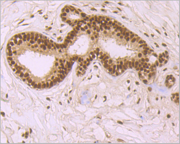 product-image-AAA30465_IHC4.jpg