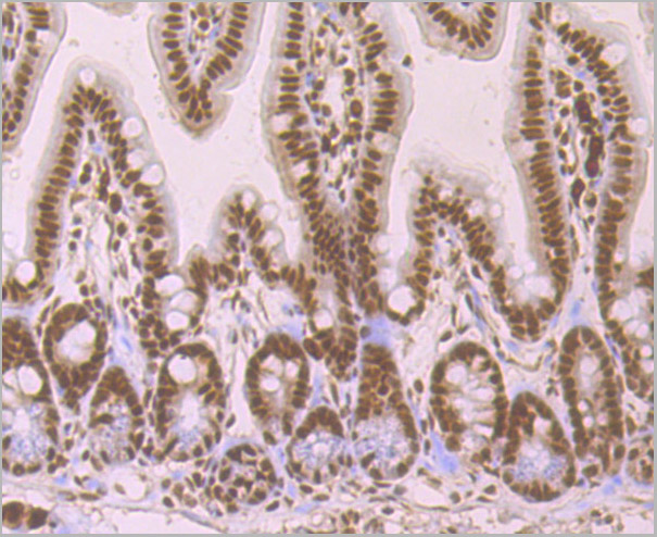 product-image-AAA30465_IHC5.jpg