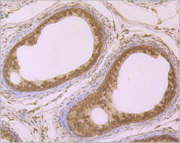product-image-AAA30465_IHC6.jpg