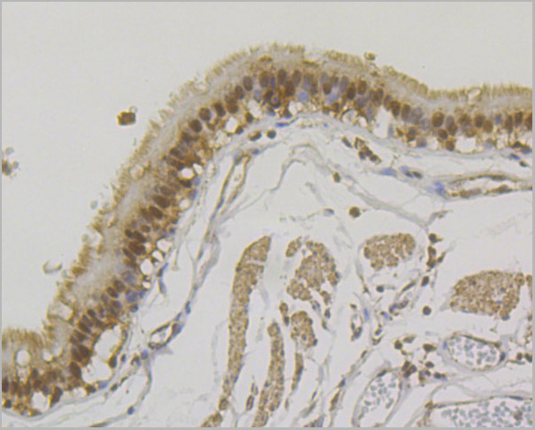 product-image-AAA30476_IHC2.jpg