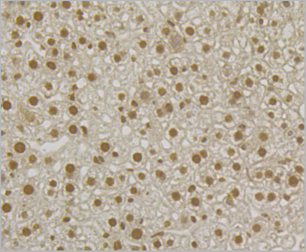 product-image-AAA30476_IHC3.jpg