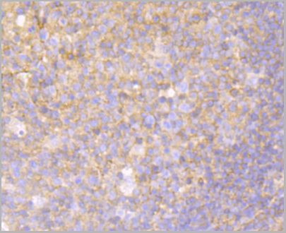 product-image-AAA30518_IHC4.jpg