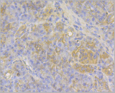 product-image-AAA30518_IHC5.jpg