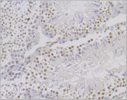 product-image-AAA30518_IHC6.jpg