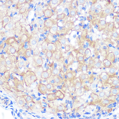 product-image-AAA30579_IHC5.jpg