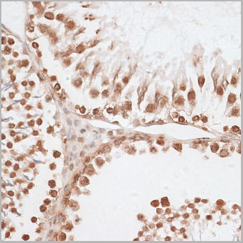 product-image-AAA30721_IHC2.jpg