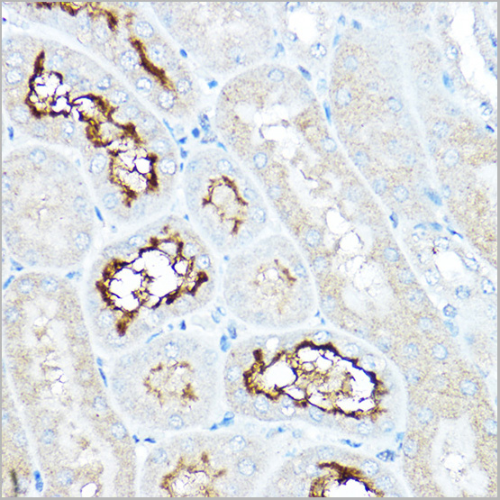 product-image-AAA30730_IHC3.jpg