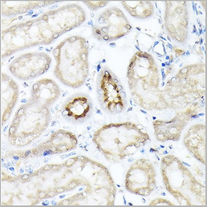 product-image-AAA30730_IHC7.jpg