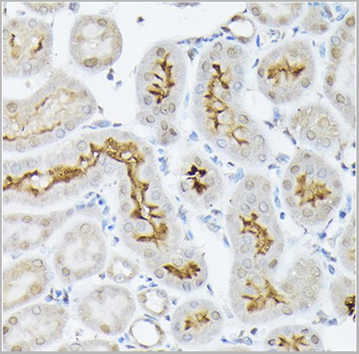 product-image-AAA30730_IHC8.jpg
