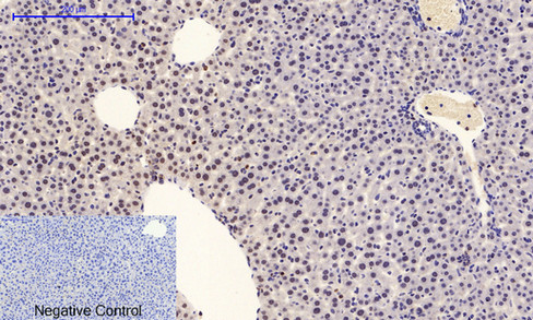 product-image-AAA30747_IHC3.png