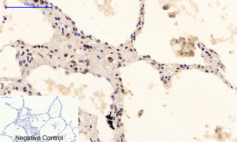 product-image-AAA30747_IHC6.png