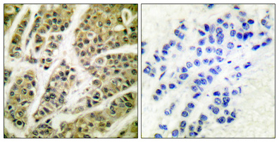 product-image-AAA30748_IHC.png