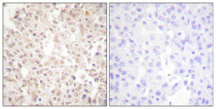 product-image-AAA30748_IHC2.png