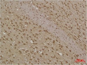 product-image-AAA30772_IHC2.png