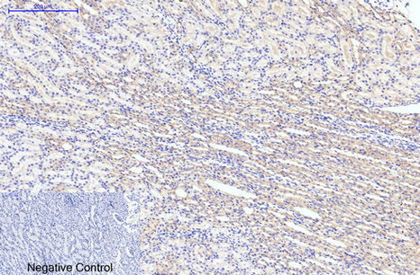 product-image-AAA30772_IHC6.png