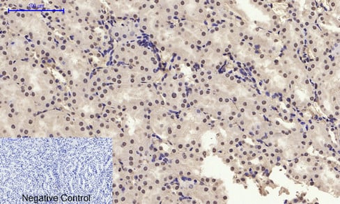 product-image-AAA30774_IHC2.png