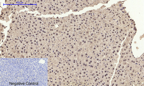 product-image-AAA30774_IHC3.png