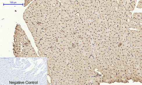 product-image-AAA30774_IHC4.png