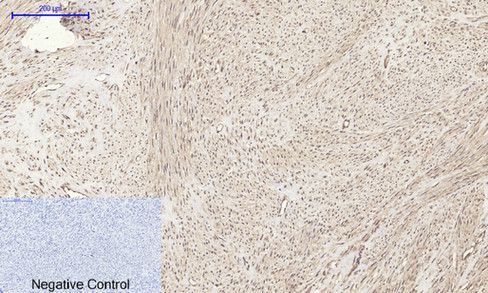 product-image-AAA30774_IHC5.png