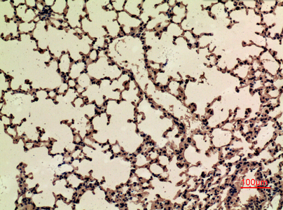 product-image-AAA30778_IHC2.png