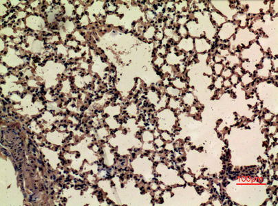 product-image-AAA30778_IHC3.png