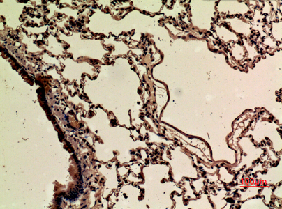 product-image-AAA30778_IHC4.png