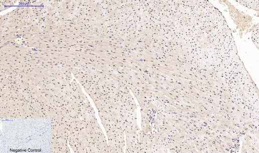 product-image-AAA30783_IHC2.png