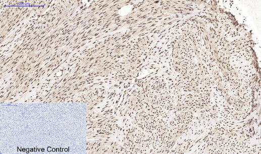 product-image-AAA30783_IHC4.png