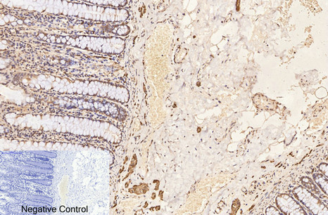 product-image-AAA30795_IHC5.png
