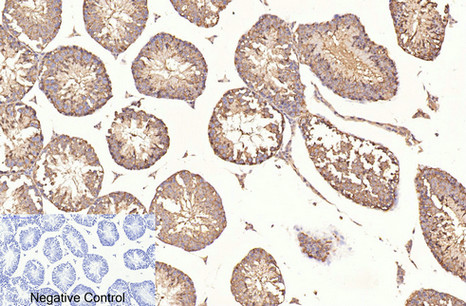 product-image-AAA30795_IHC6.png
