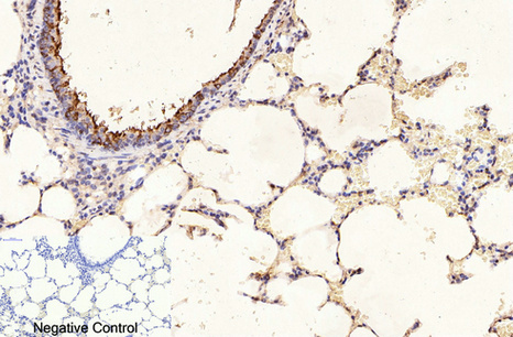 product-image-AAA30795_IHC7.png