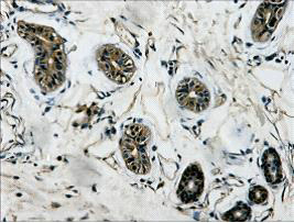 product-image-AAA30795_IHC8.png