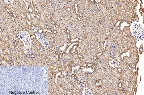product-image-AAA30797_IHC4.png